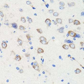 Anti-DLG1 Antibody