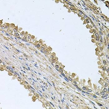 Anti-MEMO1 Antibody