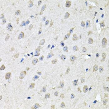 Anti-CHCHD3 Antibody