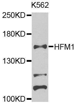 Anti-HFM1 Antibody