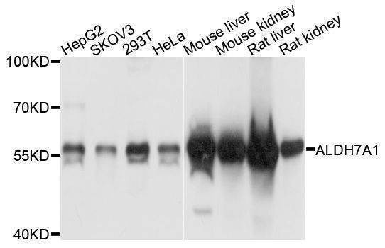 Anti-ALDH7A1 Antibody