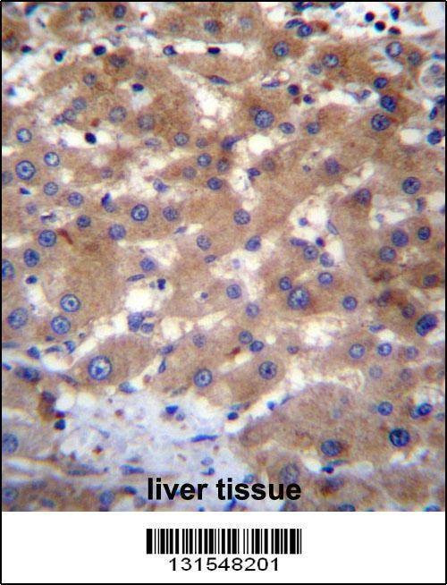 Anti-UBE2NL (N-term) Antibody