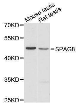 Anti-Mouse/Rat SPAG8 Antibody