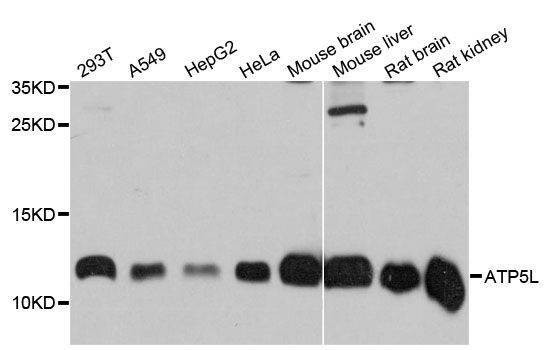 Anti-ATP5L Antibody