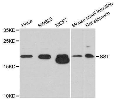Anti-SST Antibody