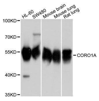 Anti-CORO1A Antibody