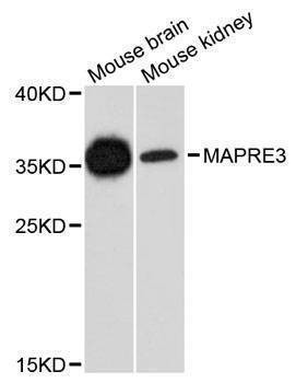 Anti-MAPRE3 Antibody