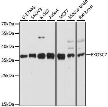 Anti-EXOSC7 Antibody
