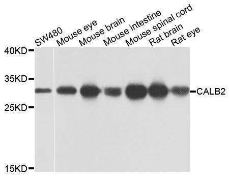 Anti-CALB2 Antibody
