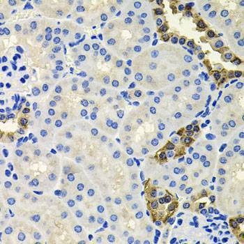Anti-CALB2 Antibody