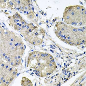 Anti-NDUFA6 Antibody