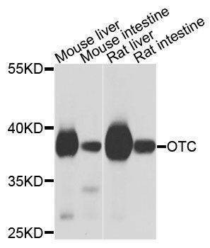 Anti-OTC Antibody