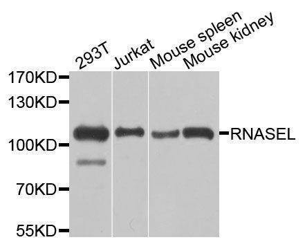 Anti-RNASEL Antibody