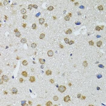 Anti-RNASEL Antibody