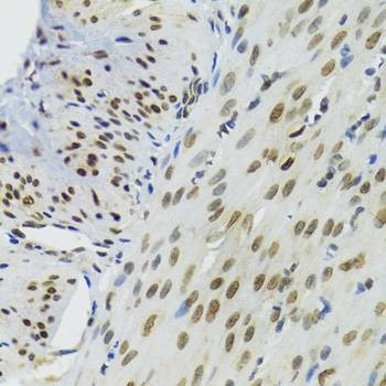 Anti-BAZ1B Antibody