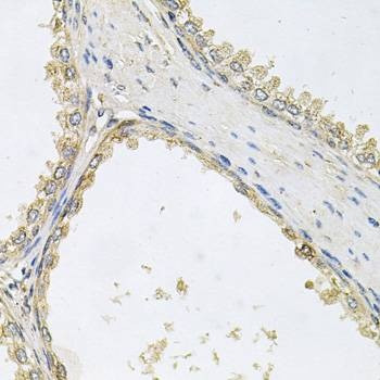 Anti-POMGNT1 Antibody