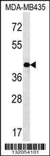 Anti-SERPINE2 (Center) Antibody