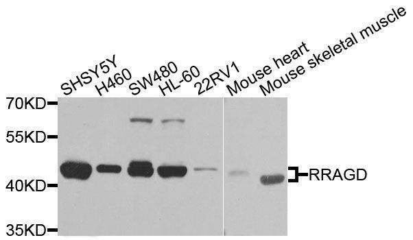 Anti-RRAGD Antibody
