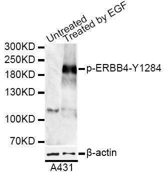 Anti-Phospho-ERBB4-Y1284 Antibody