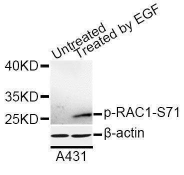 Anti-Phospho-RAC1-S71 Antibody