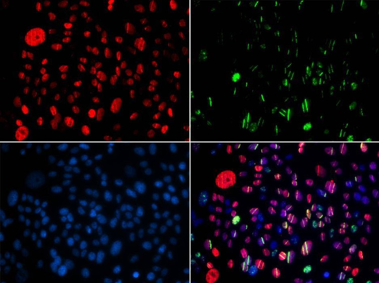 Anti-Phospho-SMC1A-S957 Antibody