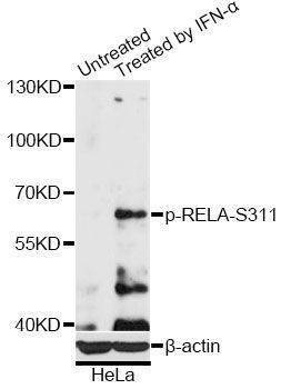 Anti-Phospho-RELA-S311 Antibody
