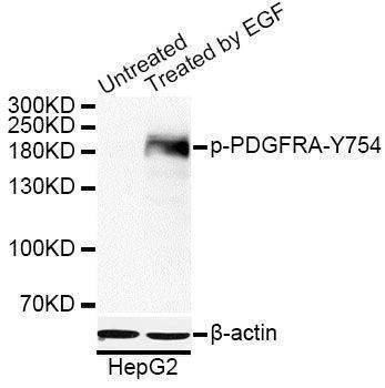 Anti-Phospho-PDGFRA-Y754 Antibody