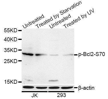 Anti-Phospho-Bcl2 -S70 Antibody