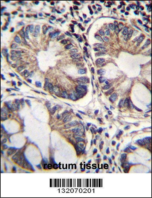 Anti-ME2 (C-term) Antibody