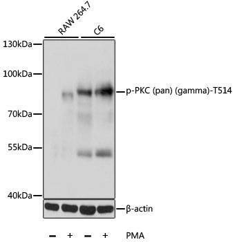 Anti-Phospho-PKC (pan) (gamma)-T514 Antibody