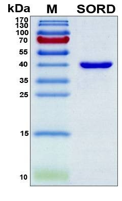 Recombinant Human Sorbitol Dehydrogenase Protein