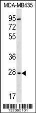 Anti-BPGM (C-term) Antibody