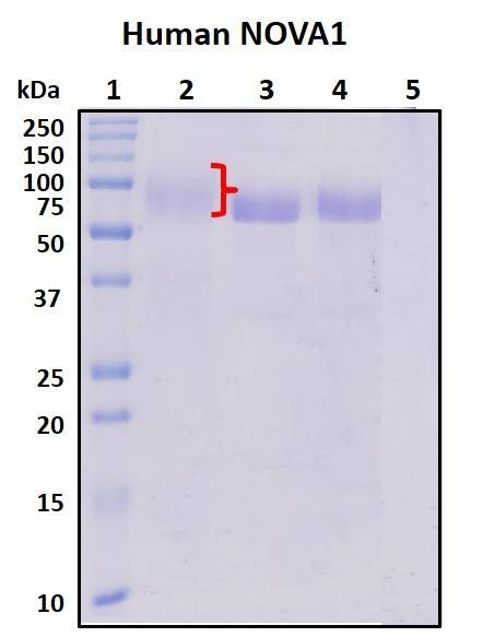 Recombinant Human Nova-1 Protein, HEK293