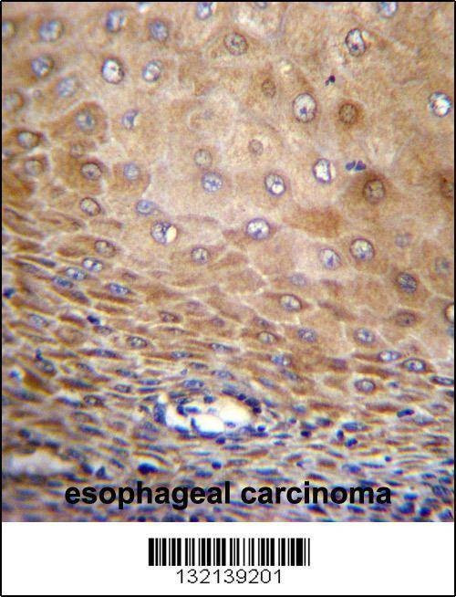 Anti-TMEM43 (Center) Antibody