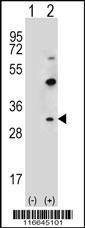 Anti-CLDN2 (C-term Y195) Antibody