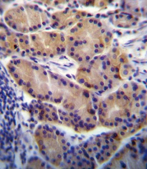 Anti-CYP2S1 (C-term) Antibody