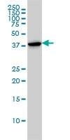 Anti-CAPG Antibody