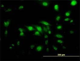 Anti-CAPG Antibody