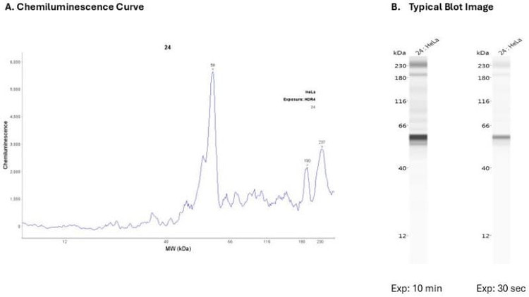 Cell lysate: Hela | Secondary Ab: Rabbit | Exposure: HDR | Expected MW (kDa): 31