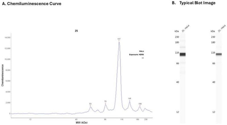 Cell lysate: Hela | Secondary Ab: Rabbit | Exposure: HDR | Expected MW (kDa): 31