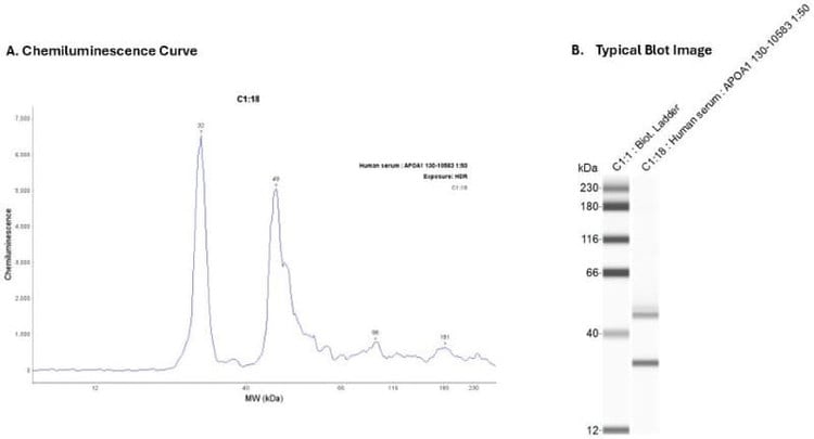 Human Serum 20X | Secondary Ab: Mouse | Exposure: HDR | Expected MW (kDa): 31