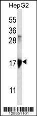 Anti-KRTAP1-3 (Center) Antibody