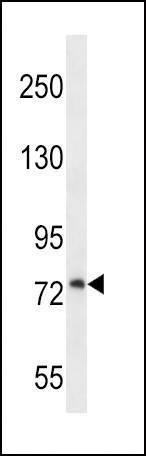 Anti-PLOD1 (N-term) Antibody