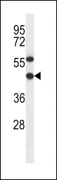 Anti-EBNA1BP2 (C-term) Antibody