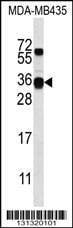 Anti-CSN2 (N-term) Antibody