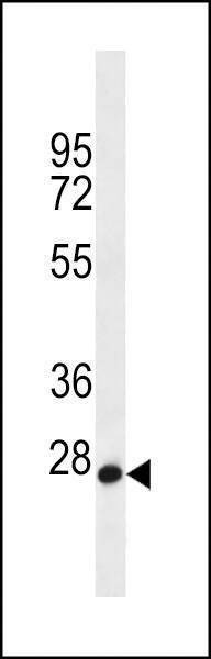 Anti-MED22 (N-term) Antibody