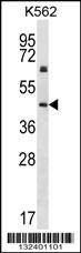 Anti-KRT12 (C-term) Antibody