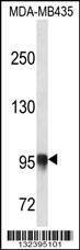 Anti-PLOD3 (N-term) Antibody