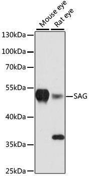 Anti-SAG Antibody