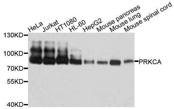 Anti-PRKCA Antibody